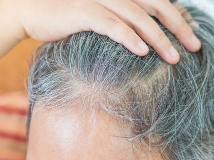 Grey hair causes at younger age these reasons are responsible for grey hair | कमी वयातच केस पांढरे झाले आहेत का?; 'या' सवयी सोडा  Grey hair causes at younger age these reasons are responsible for grey hair | कमी वयातच केस पांढरे झाले आहेत का?; 'या' सवयी सोडा