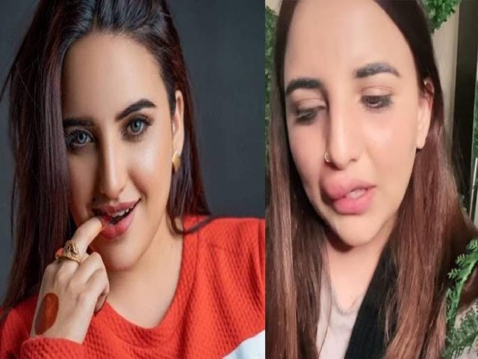 Why Pakistani TikTok Star Hareem Shah Left Midway During Lip Filler Procedure due to one call | ओठांची सर्जरी करायला UK ला गेली अन् एक कॉल येताच अर्धवटच सर्जरी केली; हरीम शाहसोबत काय घडलं?