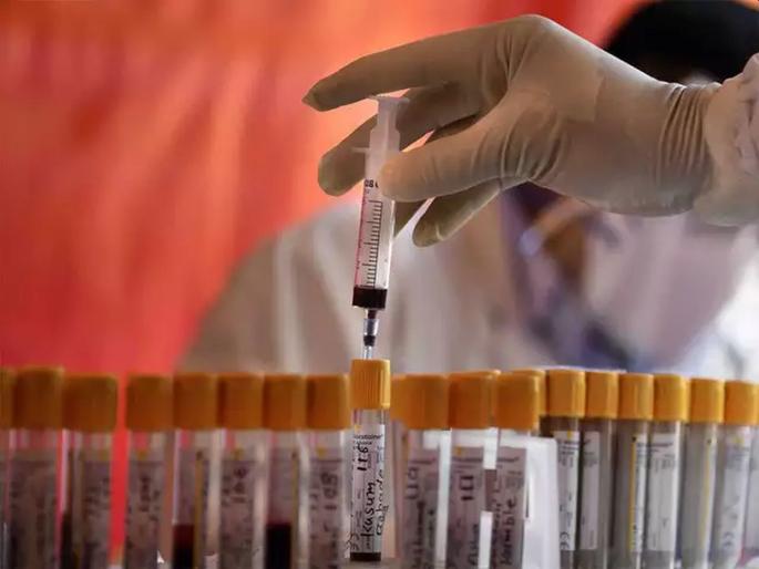 Coronavirus: Waves recede rapidly; For the first time in 74 days, over 70,000 patients | Coronavirus: लाट वेगाने ओसरतेय; ७४ दिवसांत प्रथमच ७० हजारांवर रुग्ण Coronavirus: Waves recede rapidly; For the first time in 74 days, over 70,000 patients | Coronavirus: लाट वेगाने ओसरतेय; ७४ दिवसांत प्रथमच ७० हजारांवर रुग्ण