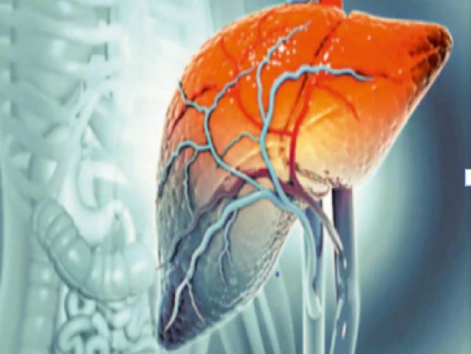 Hepatitis A New Challenge for Health Systems: 'We Are Not Waiting' | प्रासंगिक : आरोग्य व्यवस्थांपुढचे नवे आव्हान हिपॅटायटीस : ‘वी आर नॉट वेटिंग’ Hepatitis A New Challenge for Health Systems: 'We Are Not Waiting' | प्रासंगिक : आरोग्य व्यवस्थांपुढचे नवे आव्हान हिपॅटायटीस : ‘वी आर नॉट वेटिंग’