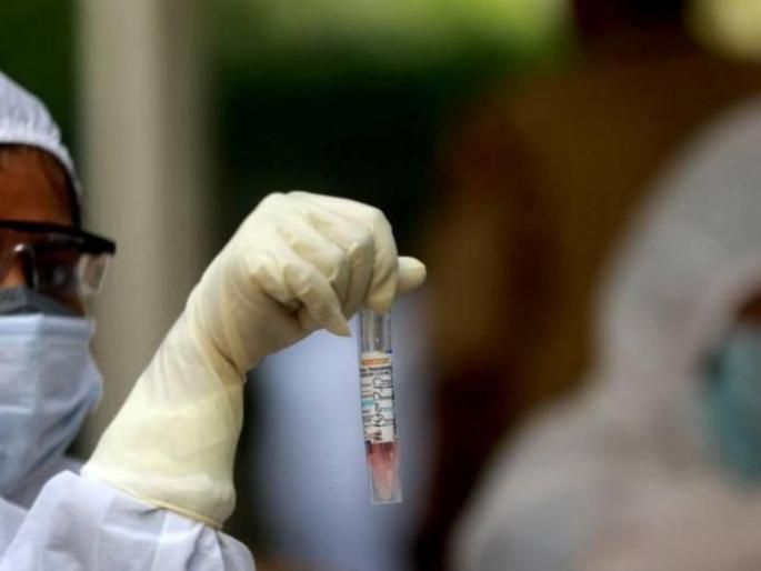 Health workers withdraw from Corona war! | आरोग्य कर्मचाऱ्यांची कोरोना युद्धातून माघार! Health workers withdraw from Corona war! | आरोग्य कर्मचाऱ्यांची कोरोना युद्धातून माघार!