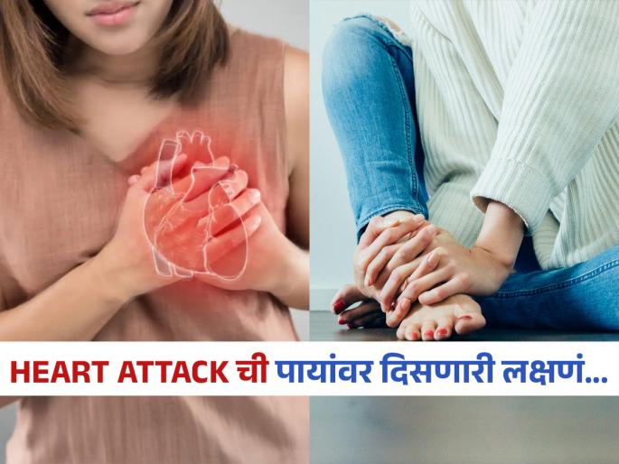 Dont avoid 3 early signs of heart attack in legs | पायांवर दिसणारे ३ बदल सांगतात, हार्ट ॲटॅकचा धोका; पाय पाहा-सावध व्हा