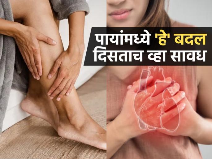 Symptoms of heart disease or heart attack seen in the legs | आधी पायांवर दिसतात हृदयात गडबडीचे संकेत, काणाडोळा केला तर वाढतो जीव जाण्याचा धोका