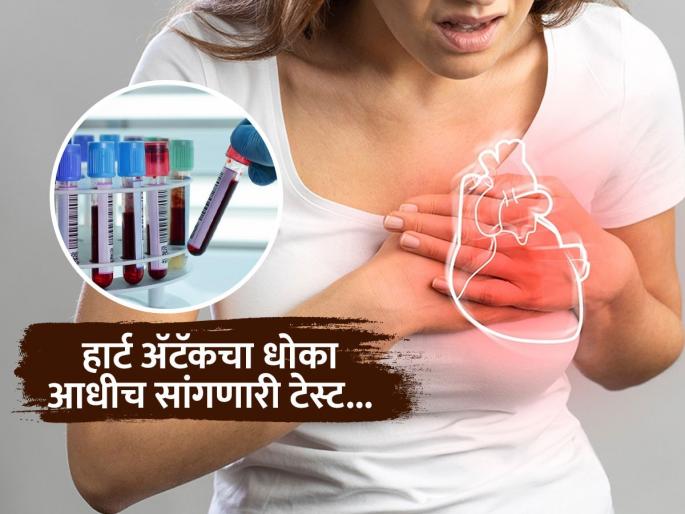 Lipoprotein blood test can detect heart attack before it occurs, everyone should know about it | हृदयविकाराचा झटका येण्याआधीच 'ही' टेस्ट देईल इशारा, जास्तीत जास्त लोक करतात याकडे दुर्लक्ष
