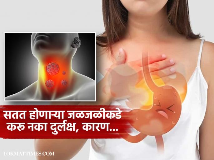 Regular heart burn could be a sign of esophageal cancer | नेहमीच छातीत जळजळ होणं असू शकतं कॅन्सरचं लक्षण, या संकेतांकडे करू नका दुर्लक्ष