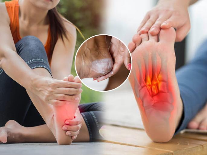 Health tips, do you have heel pain, even walking is difficult? Check out 5 home remedies - painful heels will be cured | प्रचंड टाच दुखतेय, चालण्याचेही वांधे? पाहा ५ घरगुती उपाय-ठणकणारी टाच होईल बरी-दुखणं कमी