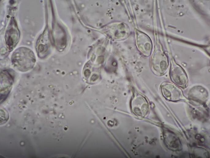 Israeli researchers say they have found first animal to survive without oxygen | नवीन शोध : प्राणवायूशिवाय जगणारा प्राणी Israeli researchers say they have found first animal to survive without oxygen | नवीन शोध : प्राणवायूशिवाय जगणारा प्राणी