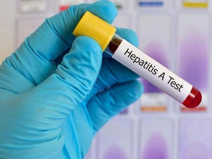 Polluted water and no hygiene will make you hepatitis patient | अशुद्ध पाणी आणि अस्वच्छतेमुळे हेपेटायटीसचा धोका! Polluted water and no hygiene will make you hepatitis patient | अशुद्ध पाणी आणि अस्वच्छतेमुळे हेपेटायटीसचा धोका!