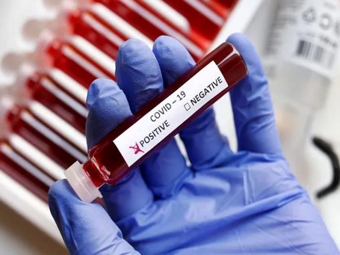 172 Corona patients in the state and 32 new patients in Mumbai; Information from State Health Department | राज्यात कोरोनाचे १७२ अन् मुंबईत ३२ नवे रुग्ण; राज्य आरोग्य विभागाची माहिती 172 Corona patients in the state and 32 new patients in Mumbai; Information from State Health Department | राज्यात कोरोनाचे १७२ अन् मुंबईत ३२ नवे रुग्ण; राज्य आरोग्य विभागाची माहिती