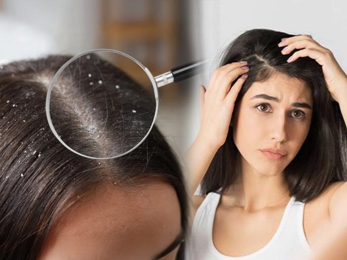 Hair care tips, Hair has become sticky due to rain? follow 3 steps hair will get soft. | पावसात भिजून - प्रवासात केस राठ कोरडे झाले? ३ उपाय - केस चटकन होतील मऊ मुलायम