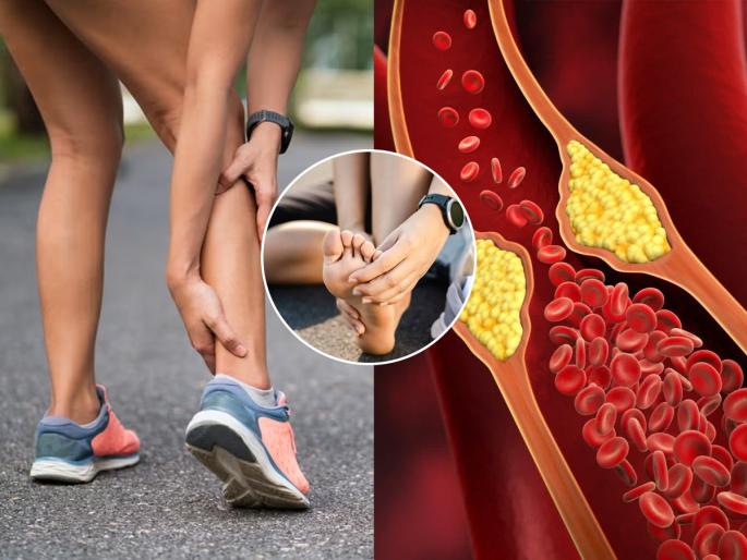 morning walk signs your body gives during high cholesterol heart attack best lifestyle changes for high cholesterol patients | मॉर्निंक वॉक करताना शरीर देतं High Alert! कोलेस्टेरॉल वाढले की, हार्ट अटॅकचा धोका? डॉक्टर सांगतात...