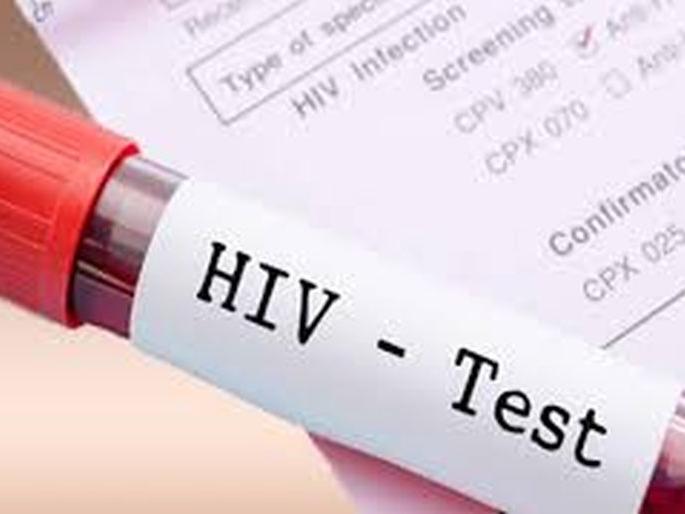 Corona causes zero HIV testing! | कोरोनामुळे ‘एचआयव्ही’ तपासणी शून्य! Corona causes zero HIV testing! | कोरोनामुळे ‘एचआयव्ही’ तपासणी शून्य!