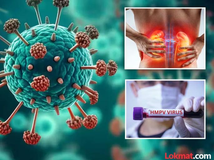 health tips hmpv virus can affects kidney function cause of acute kidney injury | किडनी डॅमेज करू शकतो HMPV व्हायरस; नव्या रिसर्चमध्ये धडकी भरवणारा खुलासा health tips hmpv virus can affects kidney function cause of acute kidney injury | किडनी डॅमेज करू शकतो HMPV व्हायरस; नव्या रिसर्चमध्ये धडकी भरवणारा खुलासा