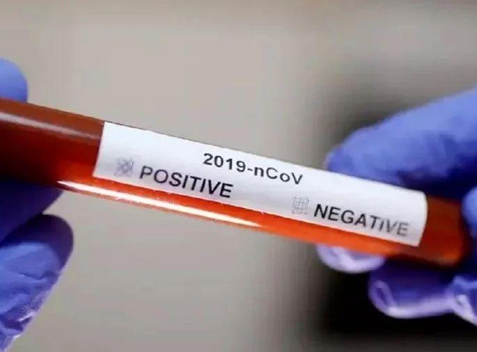 In Mira Bhayander, 12 more areas were declared affected due to corona | मीरा भाईंदरमध्ये कोरोनामुळे आणखी १२ परिसर बाधित घोषित In Mira Bhayander, 12 more areas were declared affected due to corona | मीरा भाईंदरमध्ये कोरोनामुळे आणखी १२ परिसर बाधित घोषित