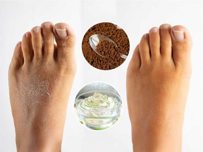 homemade foot mask for feet, how to get rid of dry feet, home hacks for dry feet and cracked heel | थंडीमुळे पाय कोरडे पडू लागले- तळपायांच्या भेगा वाढल्या? 'हा' होममेड फुटमास्क लावा- पाय होतील मऊ