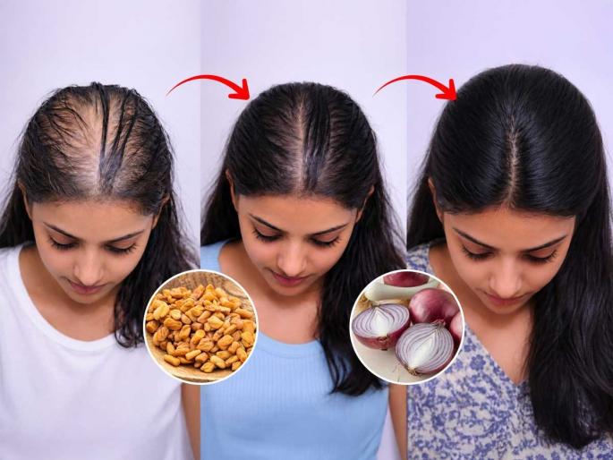 homemade hair growth serum homemade herbal hair serum onion & methi hair serum hair fall control home remedy | कचऱ्यात फेकल्या जाणाऱ्या एका गोष्टीमुळे गळणारे केस थांबतील! ना केमिकल, ना खर्च तरीही केस वाढतील भराभर... homemade hair growth serum homemade herbal hair serum onion & methi hair serum hair fall control home remedy | कचऱ्यात फेकल्या जाणाऱ्या एका गोष्टीमुळे गळणारे केस थांबतील! ना केमिकल, ना खर्च तरीही केस वाढतील भराभर...