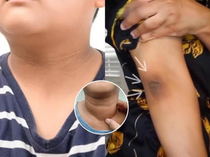 kids skincare tips for tan removal home remedy for body tanning natural ingredients for skin brightening How to Clean Blackness on Kids | दिवाळीच्या सुट्टीत उन्हांत खेळून मुलांची त्वचा झाली टॅन? १ घरगुती उपाय - रापलेली त्वचाही होईल उजळ...