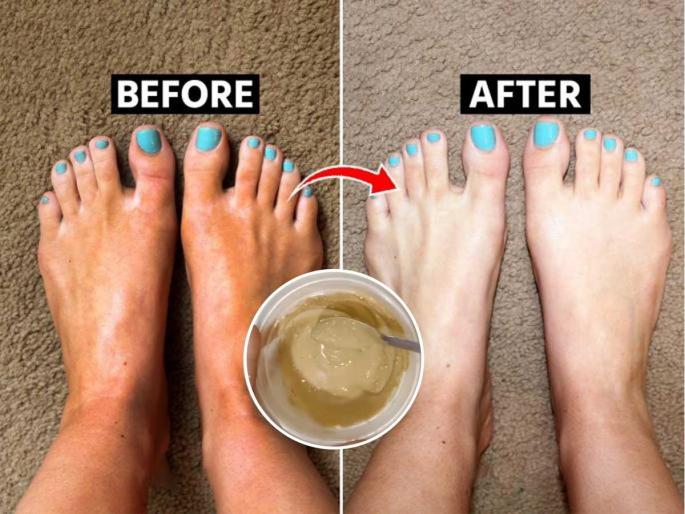 how to clean feet using toothpaste, how to do pedicure at home, home hacks to do pedicure at home, how to get pedicure like effect at home | पायावर काळे घट्टे पडले? 'अशी’ लावा टुथपेस्ट- फक्त १० मिनिटांत मिळेल पेडिक्युअरसारखा इफेक्ट how to clean feet using toothpaste, how to do pedicure at home, home hacks to do pedicure at home, how to get pedicure like effect at home | पायावर काळे घट्टे पडले? 'अशी’ लावा टुथपेस्ट- फक्त १० मिनिटांत मिळेल पेडिक्युअरसारखा इफेक्ट