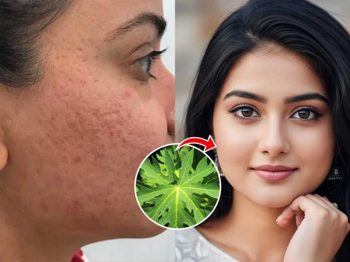 how to reduce open pores on cheeks, use of papaya leaves for skin care, home hacks for open pores | गालावरचे ओपन पोअर्स वाढल्याने चेहरा थोराड दिसतो? 'या' पानांचा लेप लावा- त्वचा दिसेल तरुण, सुंदर