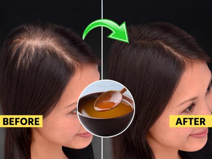 Natural Hair Loss Remedy Ayurvedic Morning Tonic for Strong and Healthy Hair Natural Hair Growth Remedy Drink : Morning Ayurvedic Drink to Stop Hair Loss Best Natural Tonic for Hair Regrowth | १ चमचा साजूक तूप आणि अश्वगंधा! हा घ्या केसगळती बंद करणारा अगदी साधासोपा उपाय...