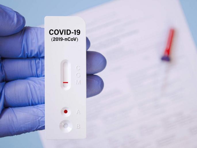 BMC Will take 20 lakh kits of antigen tests; Nine rupees for a test, report in half an hour corona Virus | CoronaVirus Mumbai: अँटीजन चाचण्यांचे २० लाख किट घेणार; एका चाचणीचे नऊ रुपये, अर्ध्या तासात अहवाल  BMC Will take 20 lakh kits of antigen tests; Nine rupees for a test, report in half an hour corona Virus | CoronaVirus Mumbai: अँटीजन चाचण्यांचे २० लाख किट घेणार; एका चाचणीचे नऊ रुपये, अर्ध्या तासात अहवाल