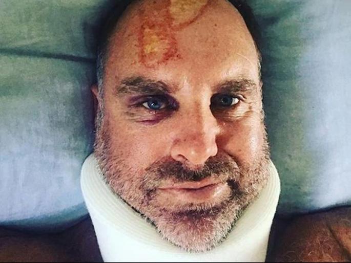 Jonty Rhodes Finds 'The Map Of Tamil Nadu' On Matthew Hayden's Head Injury | जाँटी ऱ्होड्सला दिसला अपघातग्रस्त मॅथ्यू हेडनच्या डोक्यावर तामिळनाडूचा नकाशा