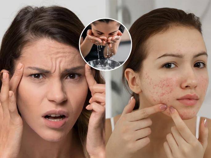 natural remedy for glowing skin how to reduce pimples and dark spots naturally ice therapy for clear skin | दिवसातून दोन वेळा चेहऱ्यावर चोळा ' हा ' पांढरा पदार्थ, डाग-सुरकुत्या- पिंपल्स होतील कमी, चेहरा दिसेल टवटवीत