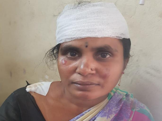 Lift of the lift, woman lamps, injuries woman injured | लिफ्टच्या बहाण्याने महिलेची चेन लंपास, झटापटीत महिला जखमी Lift of the lift, woman lamps, injuries woman injured | लिफ्टच्या बहाण्याने महिलेची चेन लंपास, झटापटीत महिला जखमी