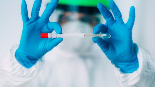 In Amravati 59 positive, total number of corona patients 914 | अमरावतीत ५९ पॉझिटिव्ह, एकूण कोरोनाबाधित रुग्णांची संख्या ९१४  In Amravati 59 positive, total number of corona patients 914 | अमरावतीत ५९ पॉझिटिव्ह, एकूण कोरोनाबाधित रुग्णांची संख्या ९१४