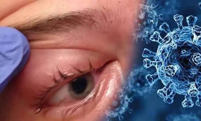 62-year-old woman dies of mucormycosis infarction in Washim district | वाशिम जिल्ह्यात म्युकरमायकोसिसचा पहिला बळी, ६२ वर्षीय महिलेचा मृत्यू 62-year-old woman dies of mucormycosis infarction in Washim district | वाशिम जिल्ह्यात म्युकरमायकोसिसचा पहिला बळी, ६२ वर्षीय महिलेचा मृत्यू