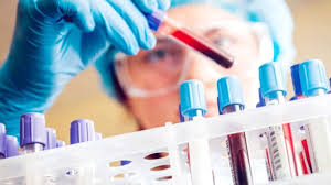 Testing of 1200 samples from the laboratory | प्रयोगशाळेकडून १२०० नमुन्यांची तपासणी Testing of 1200 samples from the laboratory | प्रयोगशाळेकडून १२०० नमुन्यांची तपासणी