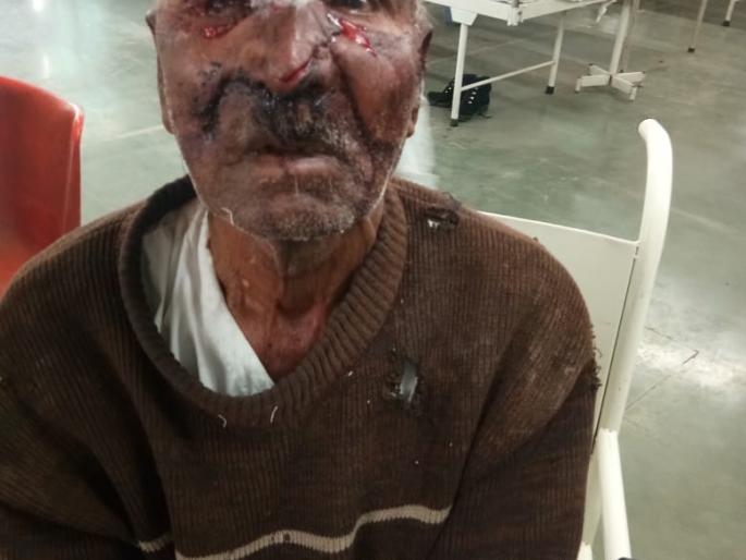 Two seriously injured in wildlife attack | वन्यप्राण्यांच्या हल्ल्यात दोघे गंभीर जखमी Two seriously injured in wildlife attack | वन्यप्राण्यांच्या हल्ल्यात दोघे गंभीर जखमी