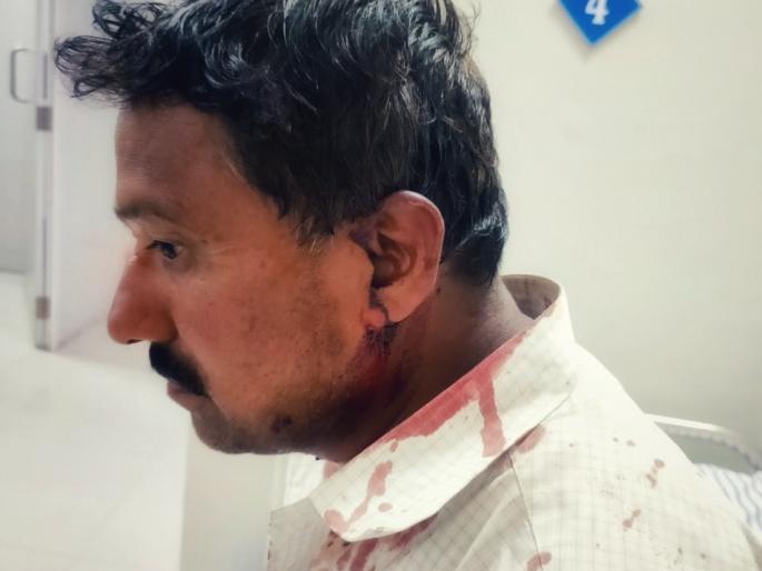 Attack on social activist Pandit Tupe in Beed | बीडमध्ये सामाजिक कार्यकर्ते पंडित तुपे यांच्यावर प्राणघातक हल्ला Attack on social activist Pandit Tupe in Beed | बीडमध्ये सामाजिक कार्यकर्ते पंडित तुपे यांच्यावर प्राणघातक हल्ला