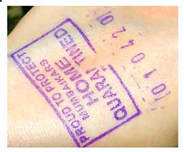 Physical assault and mental trauma! | शारीरिक हल्ला अन् मानसिक आघात ! Physical assault and mental trauma! | शारीरिक हल्ला अन् मानसिक आघात !