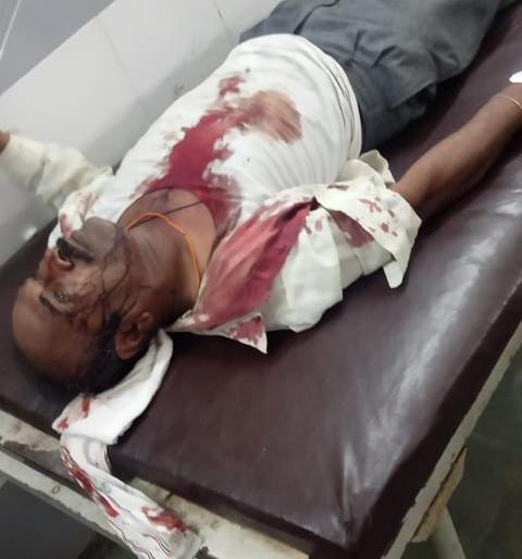 Akola: Assault on reporter for publishing news | अवैध वाळू उपशाची बातमी प्रकाशीत केली म्हणून वार्ताहरावर प्राणघातक हल्ला