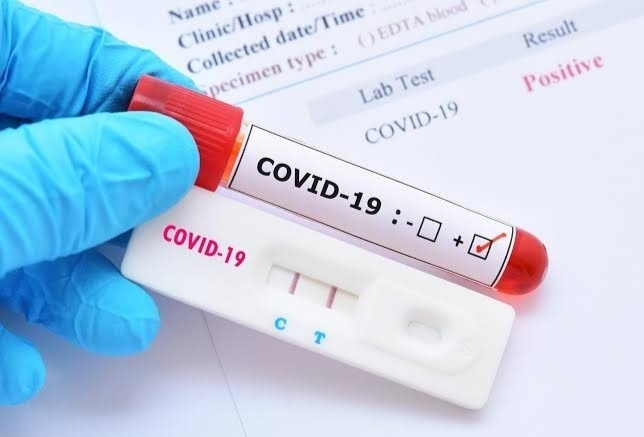 Corona virus : 241 new corona affected in pune city on tuesday ; 22 died | Corona virus : पुणे शहरात मंगळवारी २४१ नवीन कोरोनाबाधित ; २२ रुग्णांचा मृत्यू 