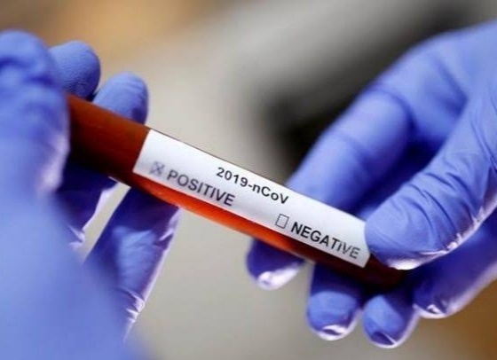 Corona virus : 377 new corona patient in pune city on sunday : 240 corona free | Corona virus : पुणे शहरात रविवारी ३७७ नवे कोरोनाबाधित : तर २४० जण कोरोनामुक्त