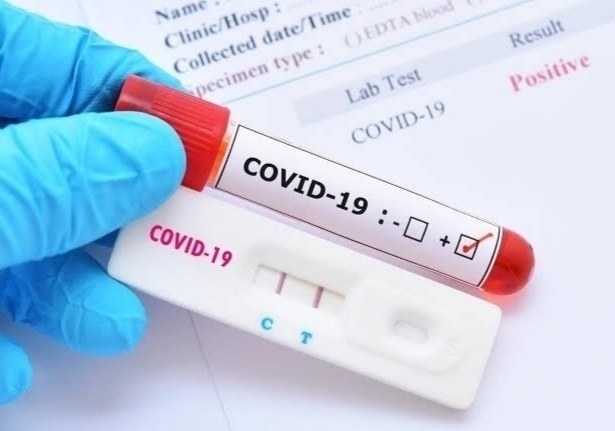 Corona virus: 172 corona viruses infected in Pimpri positive patients; 178 became better | Corona virus : पिंपरीत पॉझिटिव्ह रुग्णांपेक्षा १७२ कोरोनाबाधित ; १७८ झाले ठणठणीत बरे Corona virus: 172 corona viruses infected in Pimpri positive patients; 178 became better | Corona virus : पिंपरीत पॉझिटिव्ह रुग्णांपेक्षा १७२ कोरोनाबाधित ; १७८ झाले ठणठणीत बरे