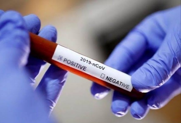 Corona virus : 185 corona infestations increase in Pune on Monday; The lowest number of patients per week | Corona virus : पुणे शहरात सोमवारी १८५ कोरोनाबाधितांची वाढ; आठवड्यातील सर्वात कमी रूग्णसंख्या Corona virus : 185 corona infestations increase in Pune on Monday; The lowest number of patients per week | Corona virus : पुणे शहरात सोमवारी १८५ कोरोनाबाधितांची वाढ; आठवड्यातील सर्वात कमी रूग्णसंख्या
