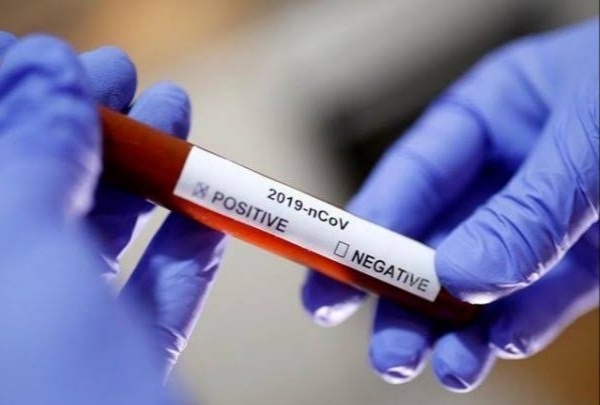 Corona virus : Pune city has the lowest ‘positivity rate’ of the Corona period | Corona virus : पुणे शहरातला कोरोना काळातील सर्वात निचांकी ‘पॉझिटिव्हीटी रेट’ Corona virus : Pune city has the lowest ‘positivity rate’ of the Corona period | Corona virus : पुणे शहरातला कोरोना काळातील सर्वात निचांकी ‘पॉझिटिव्हीटी रेट’