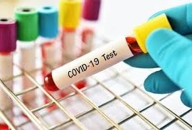 Corona virus: 254 people in Pune and 267 corona free people in Pimpri on Saturday | Corona virus : पुणे शहरात शनिवारी २५४ तर पिंपरीत २६७ जण कोरोनामुक्त Corona virus: 254 people in Pune and 267 corona free people in Pimpri on Saturday | Corona virus : पुणे शहरात शनिवारी २५४ तर पिंपरीत २६७ जण कोरोनामुक्त