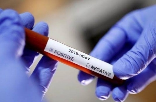 Corona Virus News : 109 new corona patients and 96 cured on sunday in pimpri | Corona Virus News : पिंपरी शहरात रविवारी नवे १०९ कोरोनाबाधित : ९६ जण कोरोनामुक्त Corona Virus News : 109 new corona patients and 96 cured on sunday in pimpri | Corona Virus News : पिंपरी शहरात रविवारी नवे १०९ कोरोनाबाधित : ९६ जण कोरोनामुक्त