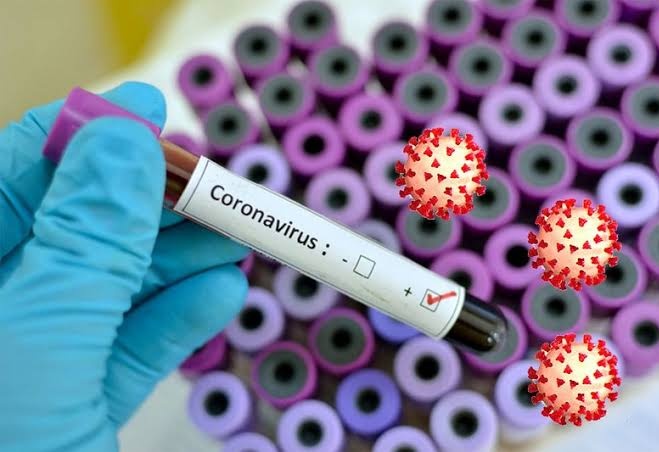 Corona Virus News: 135 new corona patients in pune and 120 pimpri on monday | Corona Virus News : पुणे शहरात सोमवारी १३५ तर पिंपरीत १२० कोरोनाबाधितांची वाढ Corona Virus News: 135 new corona patients in pune and 120 pimpri on monday | Corona Virus News : पुणे शहरात सोमवारी १३५ तर पिंपरीत १२० कोरोनाबाधितांची वाढ