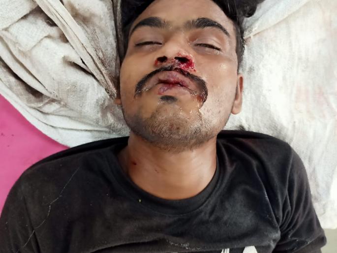 The youth was found seriously injured on the railway tracks | रेल्वेरुळावर गंभीर जखमी अवस्थेत आढळला तरुण The youth was found seriously injured on the railway tracks | रेल्वेरुळावर गंभीर जखमी अवस्थेत आढळला तरुण