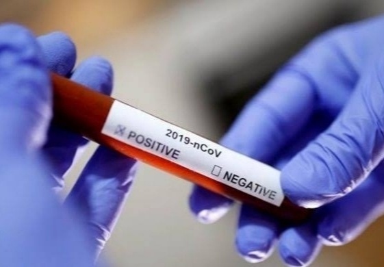 Corona Virus News: 2 thousand 342 patients in Pune city on Monday and 1187 corona patients in Pimpri | Corona Virus News : पुणे शहरात सोमवारी २ हजार ३४२ तर पिंपरीत ११८७ कोरोना रूग्णांची वाढ 