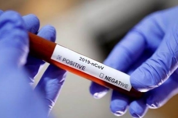 Corona virus News: The number of coronavirus victims in Pune district reached 7,000 on Friday; 3756 patients were cured | Corona virus News : पुणे जिल्ह्यात शुक्रवारी कोरोनाबाधितांचा आकडा पोहचला तब्बल ७ हजारांवर; ३,७५६ रुग्ण झाले बरे Corona virus News: The number of coronavirus victims in Pune district reached 7,000 on Friday; 3756 patients were cured | Corona virus News : पुणे जिल्ह्यात शुक्रवारी कोरोनाबाधितांचा आकडा पोहचला तब्बल ७ हजारांवर; ३,७५६ रुग्ण झाले बरे