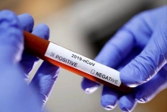 Coronavirus Pune : OMG! Corona outbreak in Pune city peaks again on Thursday, 7,000 new corona affected | Coronavirus Pune : बाप रे ! पुणे शहरात कोरोना रूग्णवाढीचा गुरुवारी पुन्हा एकदा उच्चांक, ७ हजार नवे कोरोनाबाधित Coronavirus Pune : OMG! Corona outbreak in Pune city peaks again on Thursday, 7,000 new corona affected | Coronavirus Pune : बाप रे ! पुणे शहरात कोरोना रूग्णवाढीचा गुरुवारी पुन्हा एकदा उच्चांक, ७ हजार नवे कोरोनाबाधित