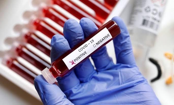 Corona Virus: 2 thousand 902 new corona positive in Pune city and 2 thousand 518 new corona in Pimpri. | Corona Virus: पुणे शहरात गुरुवारी २ हजार ९०२ तर पिंपरीत २ हजार ५१८ नवे कोरोना पॉझिटिव्ह  Corona Virus: 2 thousand 902 new corona positive in Pune city and 2 thousand 518 new corona in Pimpri. | Corona Virus: पुणे शहरात गुरुवारी २ हजार ९०२ तर पिंपरीत २ हजार ५१८ नवे कोरोना पॉझिटिव्ह