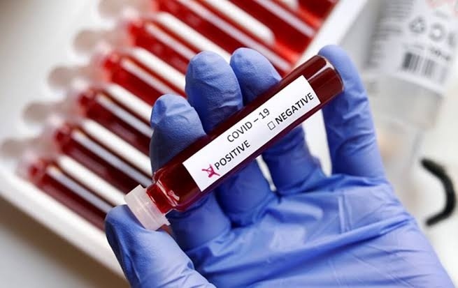 Corona Virus Pune : Increase of 588 corona victims in Pune city on Thursday: 921 corona free | Corona Virus Pune : पुणे शहरात गुरूवारी ५८८ कोरोनाबाधितांची वाढ : ९२१ कोरोनामुक्त Corona Virus Pune : Increase of 588 corona victims in Pune city on Thursday: 921 corona free | Corona Virus Pune : पुणे शहरात गुरूवारी ५८८ कोरोनाबाधितांची वाढ : ९२१ कोरोनामुक्त