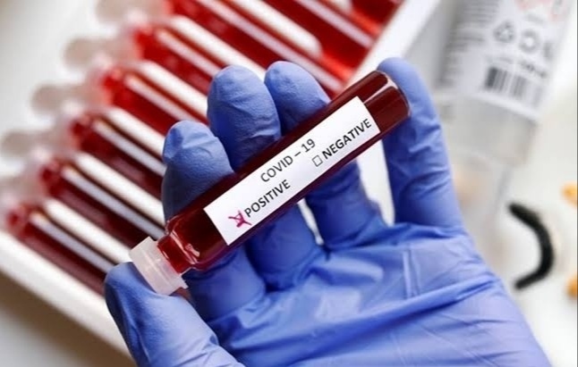 Corona virus : The number of active patients in Pune city is within 5000; On Friday, 349 new patients and 699 corona-free | Corona virus : पुणे शहरातील सक्रिय रूग्णसंख्या ५ हजारांच्या आत; शुक्रवारी ३४९ नवे रुग्ण तर ६९९ कोरोनामुक्त